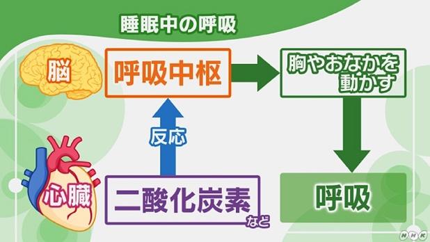 中枢性睡眠時無呼吸とは